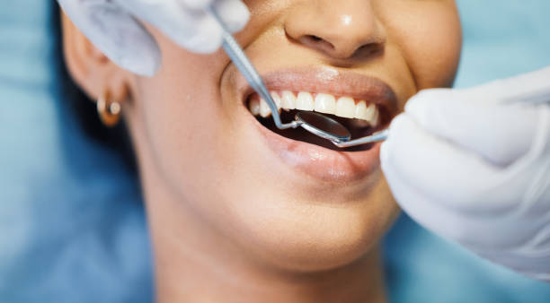Best Pediatric Emergency Dentist in Pacheco, CA