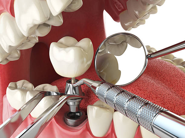 Best Walk-In Emergency Dentist in Pacheco, CA